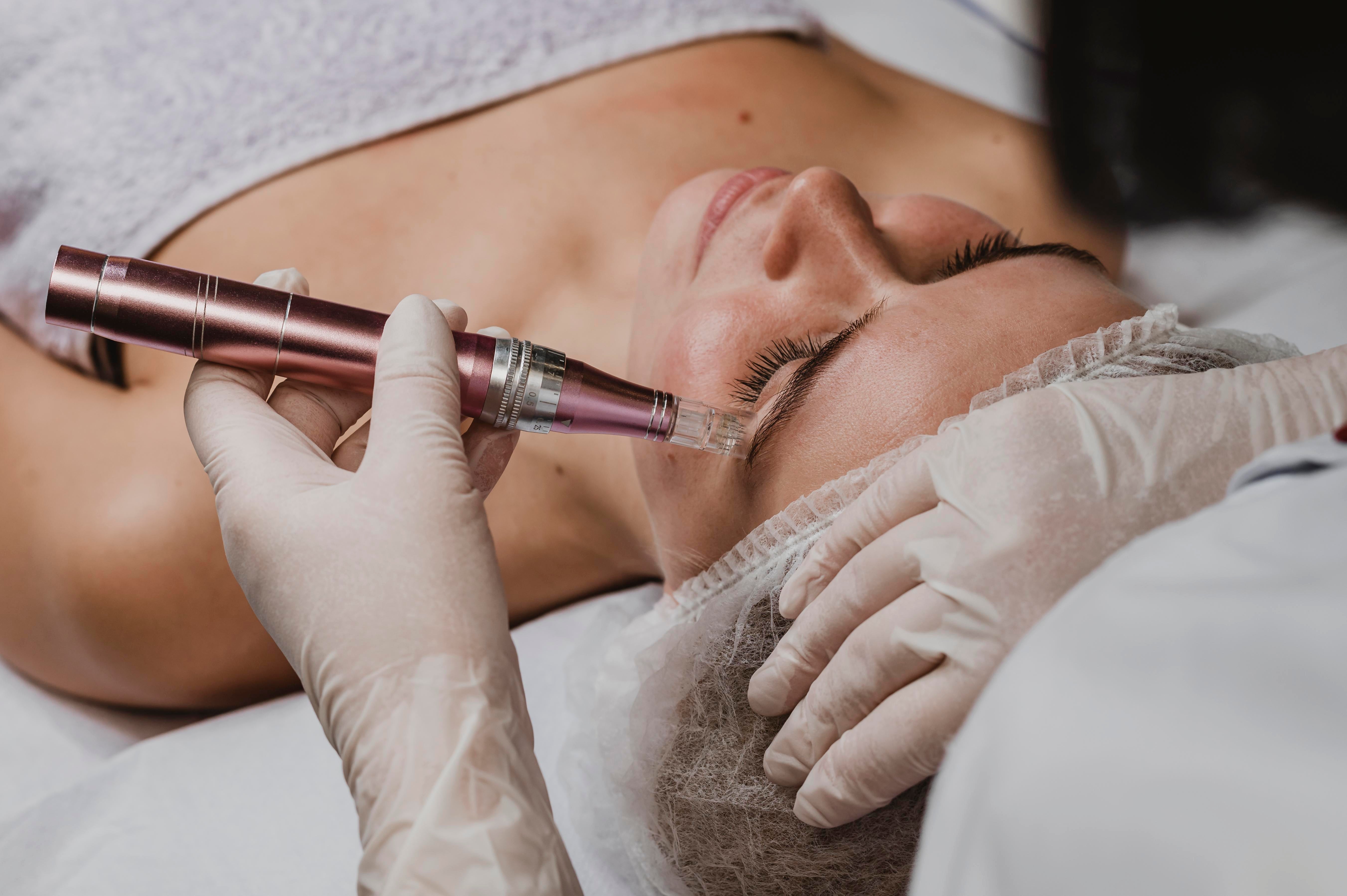 Skinpen behandling: Din vej til glattere og yngre hud